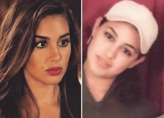صور نجمات الفن قبل وبعد عمليات التجميل.. البعض تشوه وجههن! صورة رقم 1