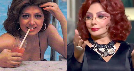 صور نجمات الفن قبل وبعد عمليات التجميل.. البعض تشوه وجههن! صورة رقم 5