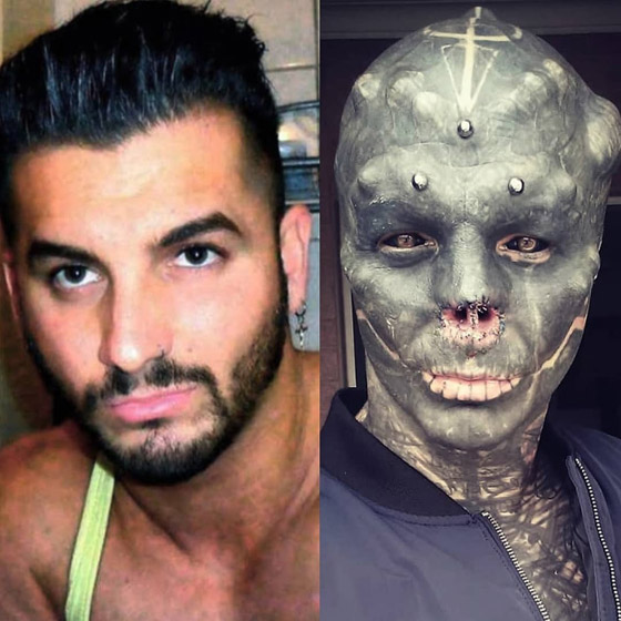 صور صادمة: شاب يشوه وجهه ويقطع أصابعه ليشبه الكائنات الفضائية! صورة رقم 2