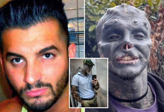 صور صادمة: شاب يشوه وجهه ويقطع أصابعه ليشبه الكائنات الفضائية! صورة رقم 11