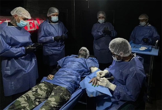 صور صادمة: شاب يشوه وجهه ويقطع أصابعه ليشبه الكائنات الفضائية! صورة رقم 5