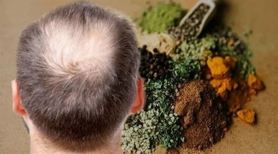 3 أعشاب تكافح تساقط الشعر صورة رقم 4