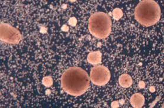 اكتشاف أول روبوت يمكنه التكاثر! يستخدمونه لأداء مهام داخل جسم الإنسان صورة رقم 13 اكتشاف أول روبوت يمكنه التكاثر! يستخدمونه لأداء مهام داخل جسم الإنسان صورة رقم 13