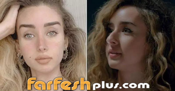 تسريب صورة الفنانة هنا الزاهد قبل عمليات التجميل والشهرة.. لن تتخيل كيف كانت! صورة رقم 1 تسريب صورة الفنانة هنا الزاهد قبل عمليات التجميل والشهرة.. لن تتخيل كيف كانت! صورة رقم 1