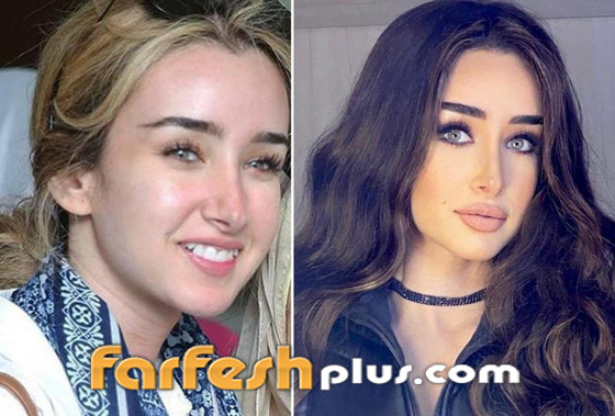تسريب صورة الفنانة هنا الزاهد قبل عمليات التجميل والشهرة.. لن تتخيل كيف كانت! صورة رقم 4 تسريب صورة الفنانة هنا الزاهد قبل عمليات التجميل والشهرة.. لن تتخيل كيف كانت! صورة رقم 4