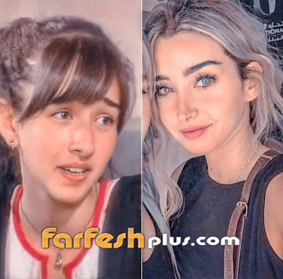 تسريب صورة الفنانة هنا الزاهد قبل عمليات التجميل والشهرة.. لن تتخيل كيف كانت! صورة رقم 5 تسريب صورة الفنانة هنا الزاهد قبل عمليات التجميل والشهرة.. لن تتخيل كيف كانت! صورة رقم 5