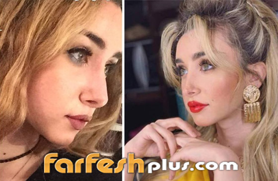 تسريب صورة الفنانة هنا الزاهد قبل عمليات التجميل والشهرة.. لن تتخيل كيف كانت! صورة رقم 6 تسريب صورة الفنانة هنا الزاهد قبل عمليات التجميل والشهرة.. لن تتخيل كيف كانت! صورة رقم 6