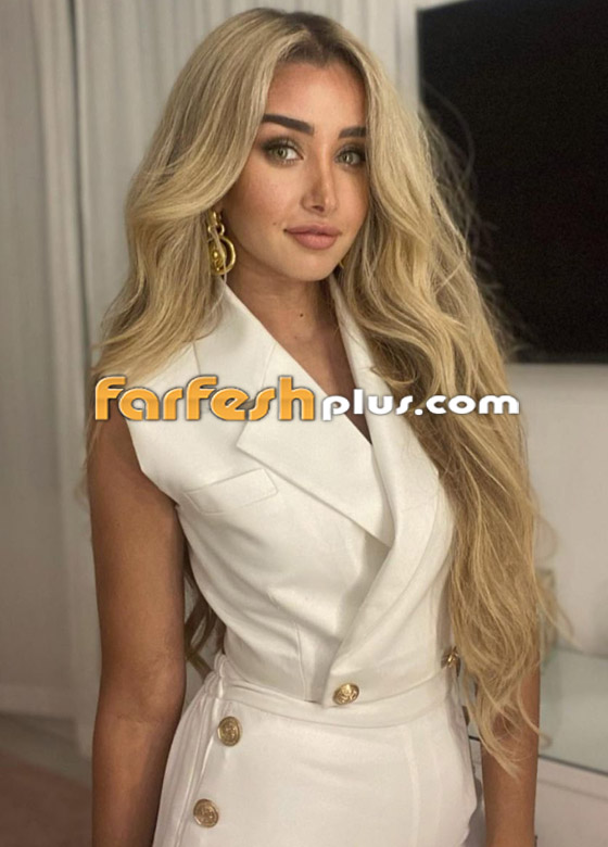 تسريب صورة الفنانة هنا الزاهد قبل عمليات التجميل والشهرة.. لن تتخيل كيف كانت! صورة رقم 17 تسريب صورة الفنانة هنا الزاهد قبل عمليات التجميل والشهرة.. لن تتخيل كيف كانت! صورة رقم 17
