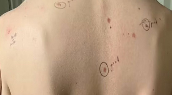 طبيب يدون ملاحظاته على جسم مريضه صورة رقم 1