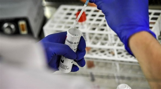 اعتقال رجل عرض عينات من كورونا للبيع على الإنترنت صورة رقم 1