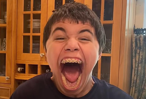 فيديو وصور: أمريكي يدخل موسوعة غينيس لامتلاكه أكبر فم في العالم صورة رقم 6 فيديو وصور: أمريكي يدخل موسوعة غينيس لامتلاكه أكبر فم في العالم صورة رقم 6