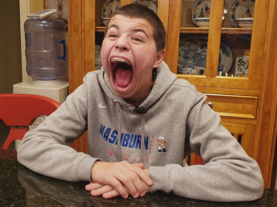 فيديو وصور: أمريكي يدخل موسوعة غينيس لامتلاكه أكبر فم في العالم صورة رقم 7 فيديو وصور: أمريكي يدخل موسوعة غينيس لامتلاكه أكبر فم في العالم صورة رقم 7