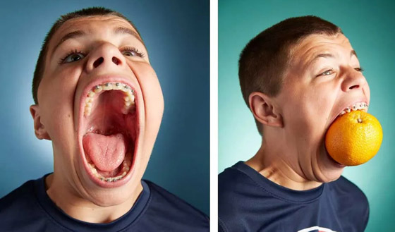 فيديو وصور: أمريكي يدخل موسوعة غينيس لامتلاكه أكبر فم في العالم صورة رقم 8 فيديو وصور: أمريكي يدخل موسوعة غينيس لامتلاكه أكبر فم في العالم صورة رقم 8