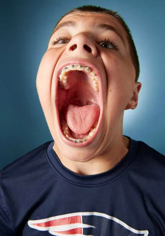 فيديو وصور: أمريكي يدخل موسوعة غينيس لامتلاكه أكبر فم في العالم صورة رقم 9 فيديو وصور: أمريكي يدخل موسوعة غينيس لامتلاكه أكبر فم في العالم صورة رقم 9