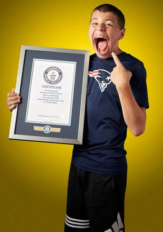 فيديو وصور: أمريكي يدخل موسوعة غينيس لامتلاكه أكبر فم في العالم صورة رقم 1 فيديو وصور: أمريكي يدخل موسوعة غينيس لامتلاكه أكبر فم في العالم صورة رقم 1