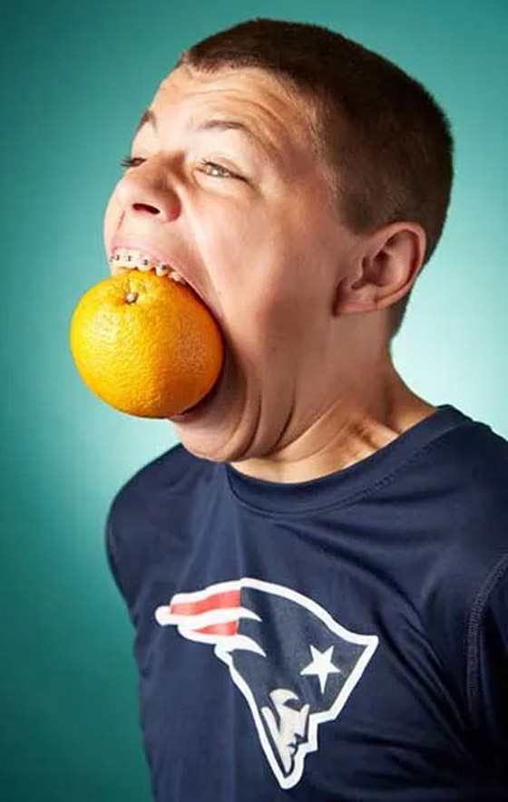 فيديو وصور: أمريكي يدخل موسوعة غينيس لامتلاكه أكبر فم في العالم صورة رقم 10 فيديو وصور: أمريكي يدخل موسوعة غينيس لامتلاكه أكبر فم في العالم صورة رقم 10