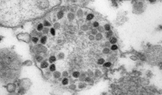 خبر رائع: لا تقلقوا فنهاية وباء كورونا قريبة رغم أوميكرون! صورة رقم 2