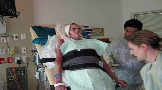 يتعافى بأعجوبة من صدمتين كهربائتين عنيفتين صورة رقم 1