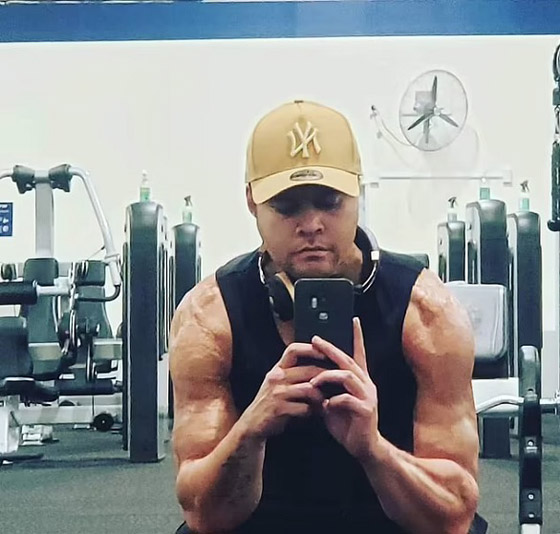 يتعافى بأعجوبة من صدمتين كهربائتين عنيفتين صورة رقم 3