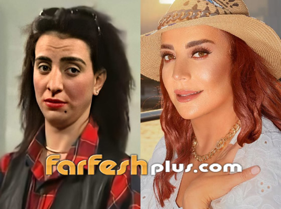 شكران مرتجى ترد ردا ناريا على متنمر سخر من أنفها قبل التجميل صورة رقم 5