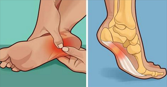 نصائح لعلاج آلام كعب القدمين صورة رقم 4
