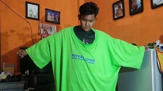 أثقل طفل في العالم يخسر 120 كيلوغراماً من وزنه صورة رقم 1