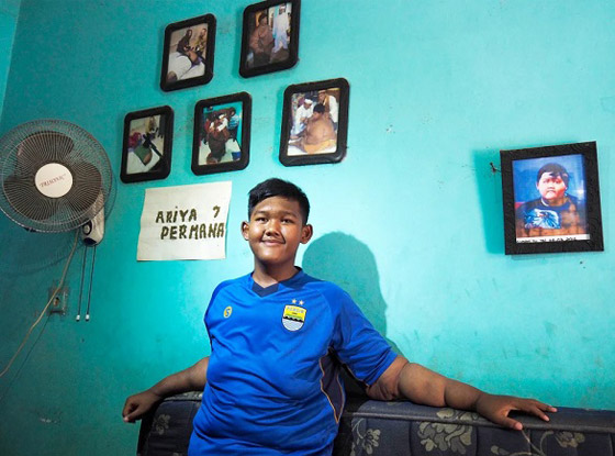 أثقل طفل في العالم يخسر 120 كيلوغراماً من وزنه صورة رقم 8