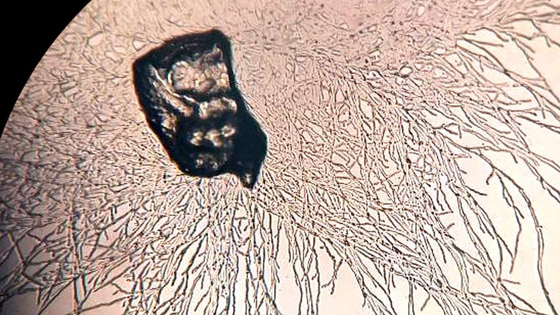 الفطريات والبكتيريا آكلة البلاستيك التي قد تنقذ العالم من النفايات صورة رقم 2