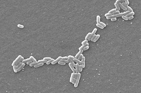 الفطريات والبكتيريا آكلة البلاستيك التي قد تنقذ العالم من النفايات صورة رقم 3