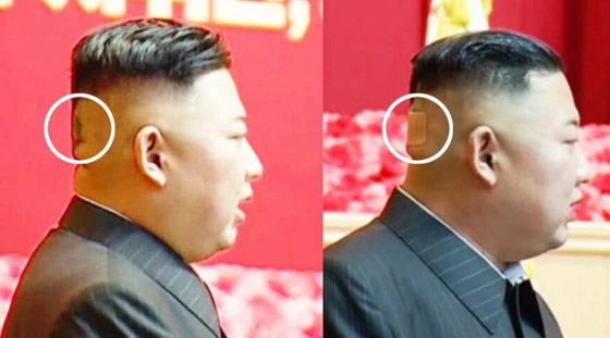 كدمة داكنة وضمادة.. رأس زعيم كوريا الشمالية كيم يثير الحيرة والمخاوف! صورة رقم 1 كدمة داكنة وضمادة.. رأس زعيم كوريا الشمالية كيم يثير الحيرة والمخاوف! صورة رقم 1