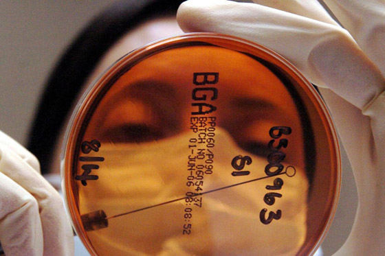 علماء يكتشفون فيروسا جديدا مفيدا للإنسان! يساهم بمكافحة عدوى البكتيريا صورة رقم 4