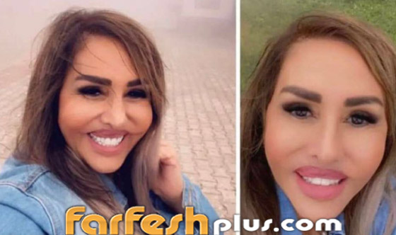 صور صادمة: الفنانة مها المصري بوجه مشوه بعد عملية تجميل جديدة والجمهور: يكسر ايدين الدكتور! صورة رقم 1