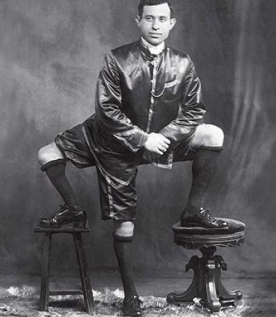 9 نجوم لسيرك (بارنوم) اشتهروا بسماتهم الغريبة: رجل بـ3 أرجل وامرأة ملتحية صورة رقم 1