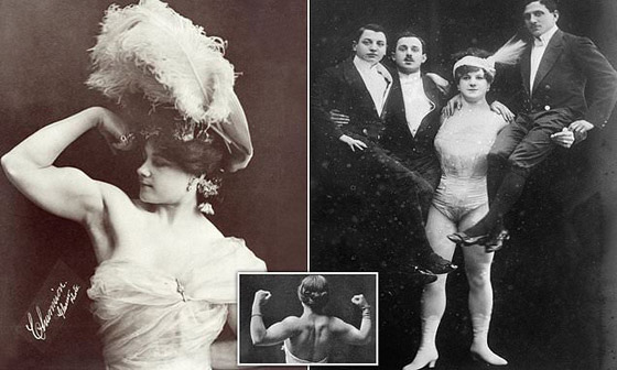 9 نجوم لسيرك (بارنوم) اشتهروا بسماتهم الغريبة: رجل بـ3 أرجل وامرأة ملتحية صورة رقم 2