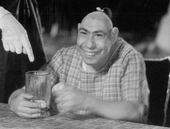 9 نجوم لسيرك (بارنوم) اشتهروا بسماتهم الغريبة: رجل بـ3 أرجل وامرأة ملتحية صورة رقم 3