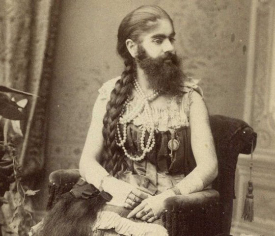 9 نجوم لسيرك (بارنوم) اشتهروا بسماتهم الغريبة: رجل بـ3 أرجل وامرأة ملتحية صورة رقم 4