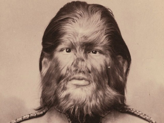 9 نجوم لسيرك (بارنوم) اشتهروا بسماتهم الغريبة: رجل بـ3 أرجل وامرأة ملتحية صورة رقم 7