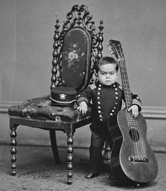 9 نجوم لسيرك (بارنوم) اشتهروا بسماتهم الغريبة: رجل بـ3 أرجل وامرأة ملتحية صورة رقم 9