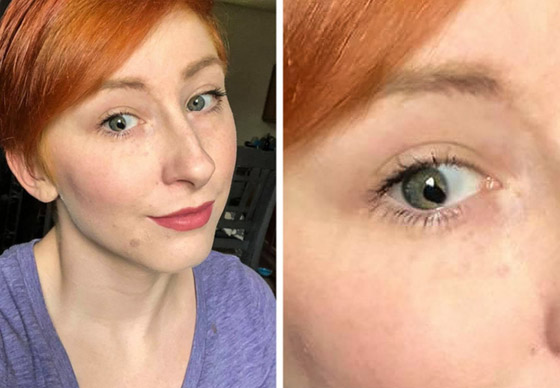 مميزون عن غيرهم.. شاهد أشخاص وحيوانات بعلامات غريبة على أجسامهم صورة رقم 2