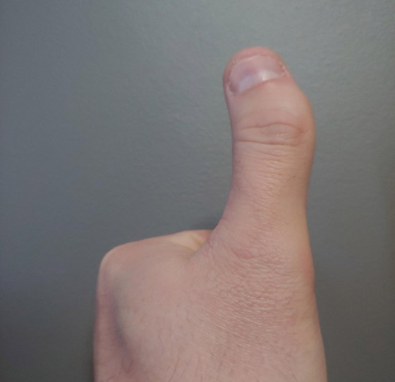 مميزون عن غيرهم.. شاهد أشخاص وحيوانات بعلامات غريبة على أجسامهم صورة رقم 3