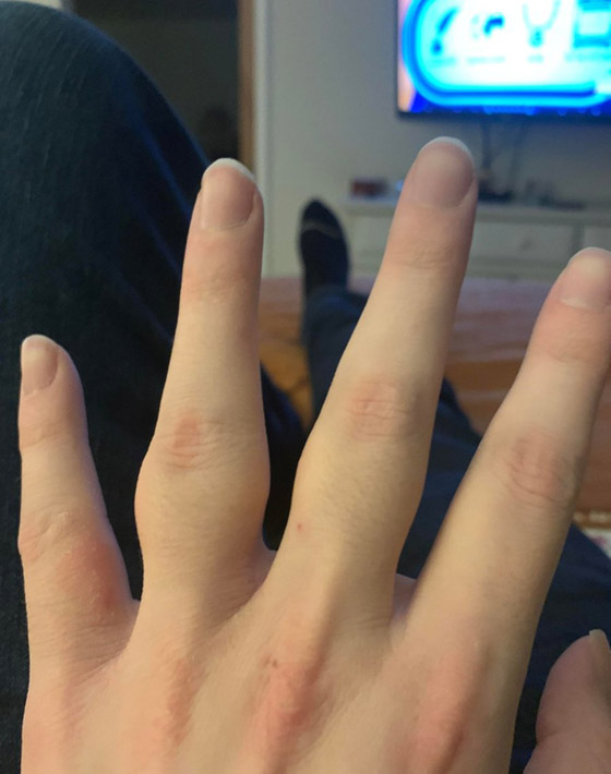 مميزون عن غيرهم.. شاهد أشخاص وحيوانات بعلامات غريبة على أجسامهم صورة رقم 8