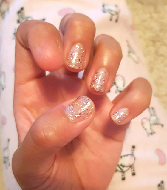 مميزون عن غيرهم.. شاهد أشخاص وحيوانات بعلامات غريبة على أجسامهم صورة رقم 11