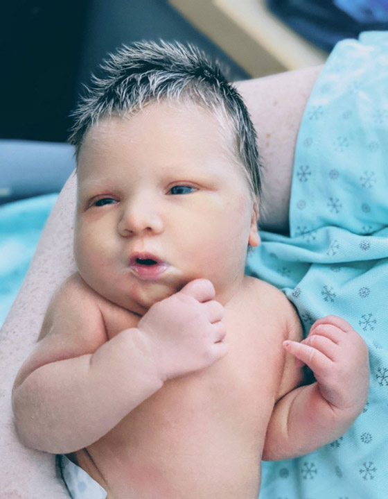 مميزون عن غيرهم.. شاهد أشخاص وحيوانات بعلامات غريبة على أجسامهم صورة رقم 1