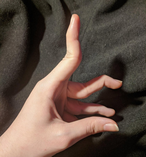 مميزون عن غيرهم.. شاهد أشخاص وحيوانات بعلامات غريبة على أجسامهم صورة رقم 13