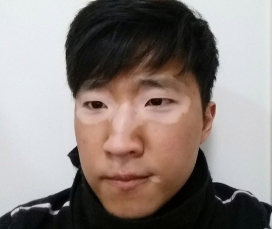 مميزون عن غيرهم.. شاهد أشخاص وحيوانات بعلامات غريبة على أجسامهم صورة رقم 9