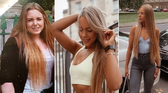 تصاب بحالة نادرة تجعلها تخشى تناول الطعام صورة رقم 1