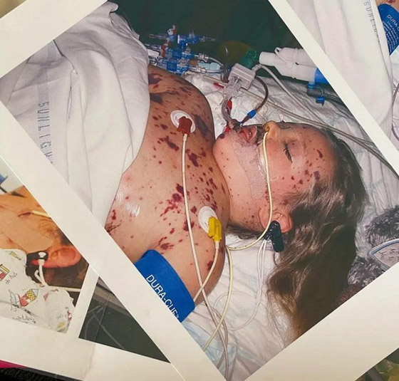 تنشر دروس تجميل رغم فقدانها ليديها وساقيها صورة رقم 5 تنشر دروس تجميل رغم فقدانها ليديها وساقيها صورة رقم 5