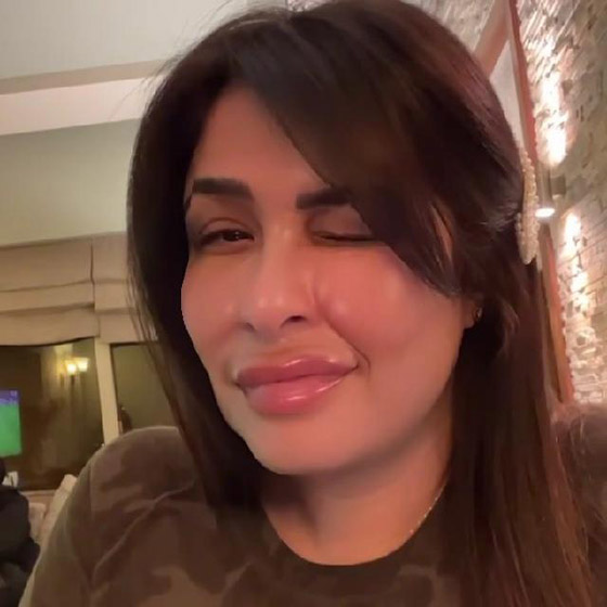 ما سر عملية التجميل التي أجرتها ياسمين عبدالعزيز وغيرت ملامحها؟ صورة رقم 2 ما سر عملية التجميل التي أجرتها ياسمين عبدالعزيز وغيرت ملامحها؟ صورة رقم 2