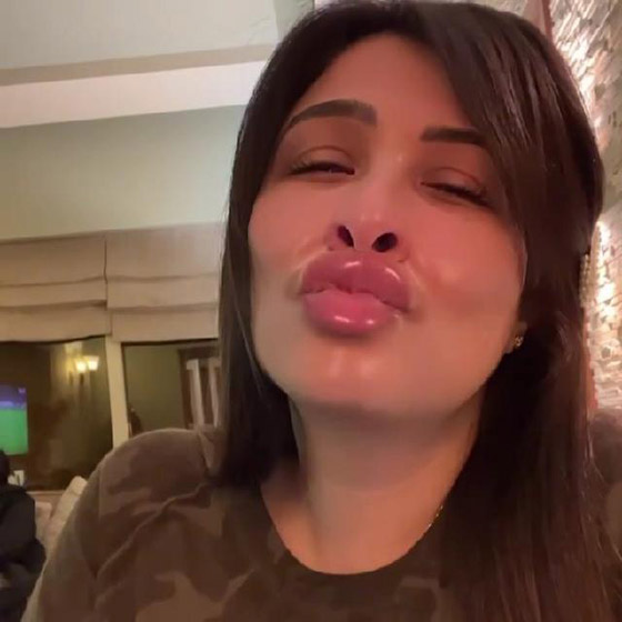 ما سر عملية التجميل التي أجرتها ياسمين عبدالعزيز وغيرت ملامحها؟ صورة رقم 3 ما سر عملية التجميل التي أجرتها ياسمين عبدالعزيز وغيرت ملامحها؟ صورة رقم 3