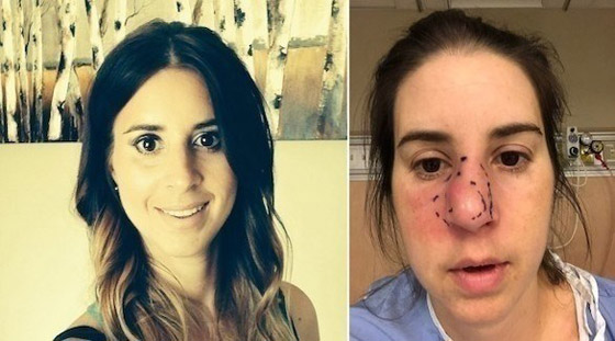 تزيل أنفها بالكامل بسبب آلامها المبرحة صورة رقم 1